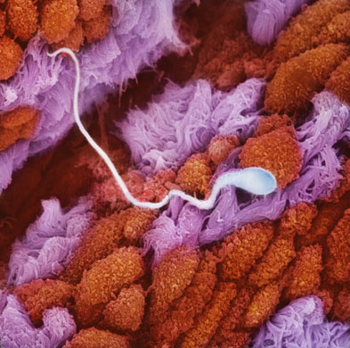 0110 受孕 一个精子游向输卵管黏液膜褶内的一个卵子.jpg