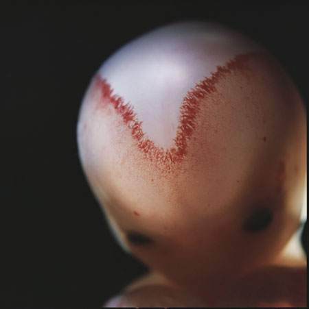 0710 9周后 V形血管在头骨融汇处发育.jpg