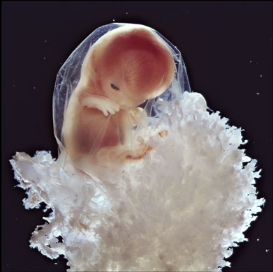 0810 10周后 大约3厘米长的胚胎进入胎儿阶段.jpg